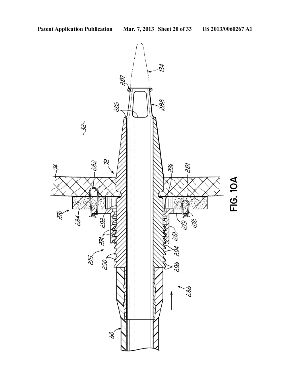 CANNULA TIPS, TISSUE ATTACHMENT RINGS, AND METHODS OF DELIVERING AND USING     THE SAME - diagram, schematic, and image 21