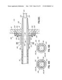 CANNULA TIPS, TISSUE ATTACHMENT RINGS, AND METHODS OF DELIVERING AND USING     THE SAME diagram and image