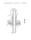 CANNULA TIPS, TISSUE ATTACHMENT RINGS, AND METHODS OF DELIVERING AND USING     THE SAME diagram and image