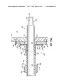 CANNULA TIPS, TISSUE ATTACHMENT RINGS, AND METHODS OF DELIVERING AND USING     THE SAME diagram and image