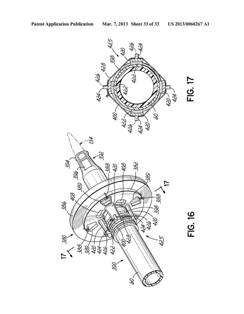 CANNULA TIPS, TISSUE ATTACHMENT RINGS, AND METHODS OF DELIVERING AND USING     THE SAME - diagram, schematic, and image 34