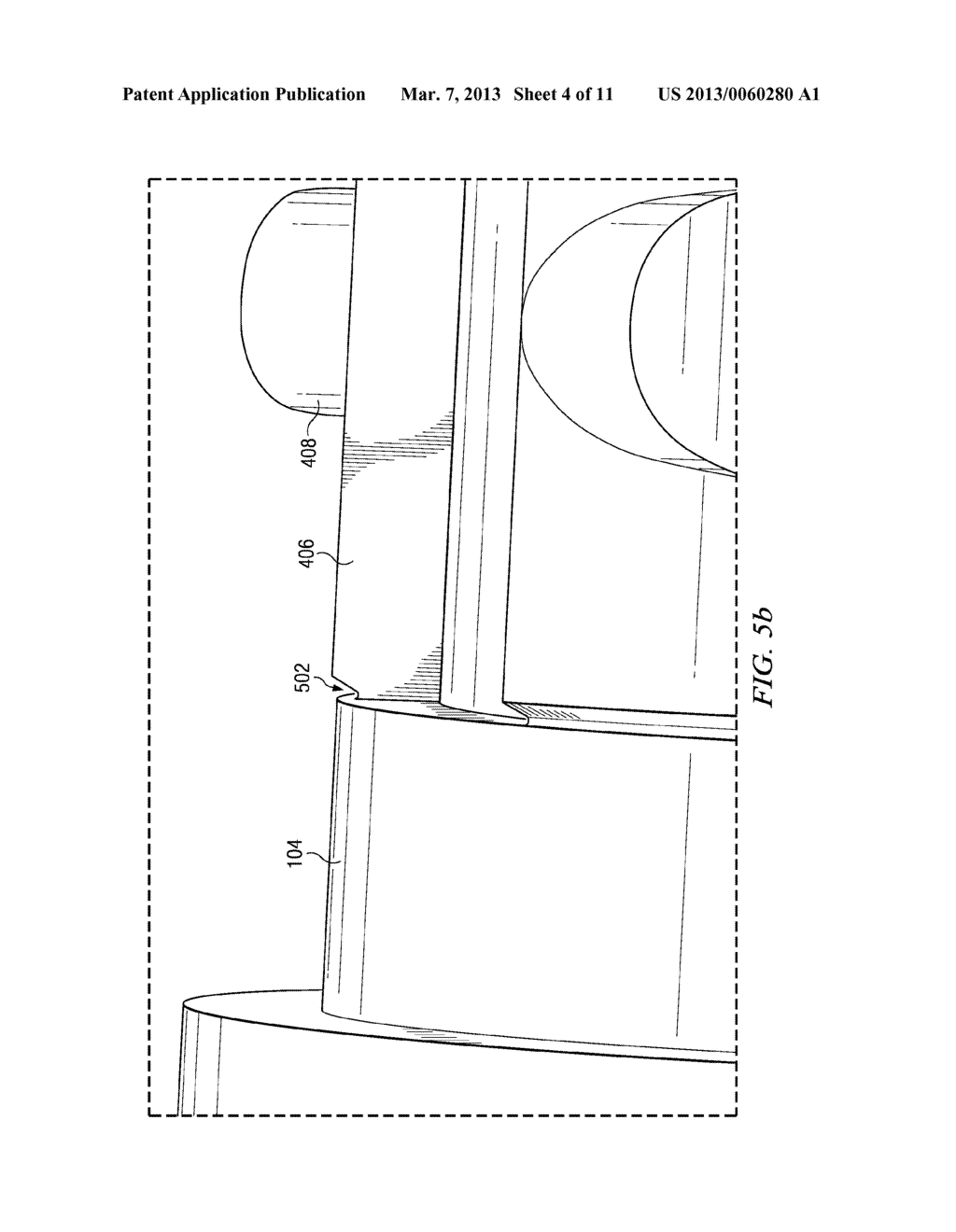 BONE ANCHOR HAVING AN INTEGRATED STRESS ISOLATOR - diagram, schematic, and image 05