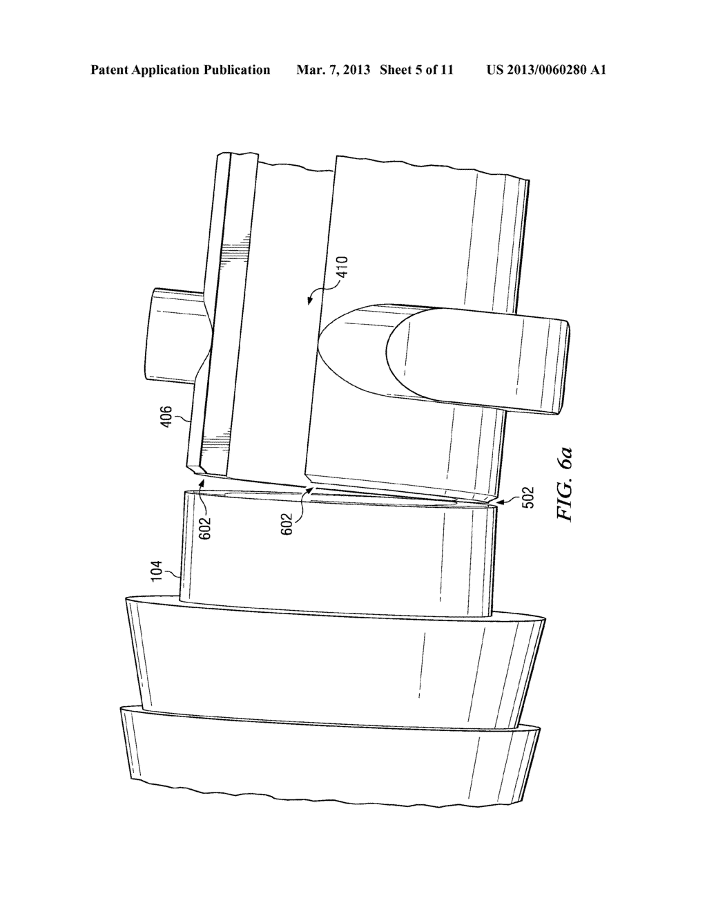 BONE ANCHOR HAVING AN INTEGRATED STRESS ISOLATOR - diagram, schematic, and image 06