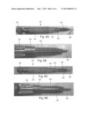 Spinal Plate diagram and image