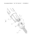 Bone Implants diagram and image