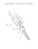 Bone Implants diagram and image