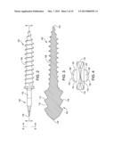 HAMMER TOE IMPLANT diagram and image