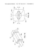 HAMMER TOE IMPLANT diagram and image