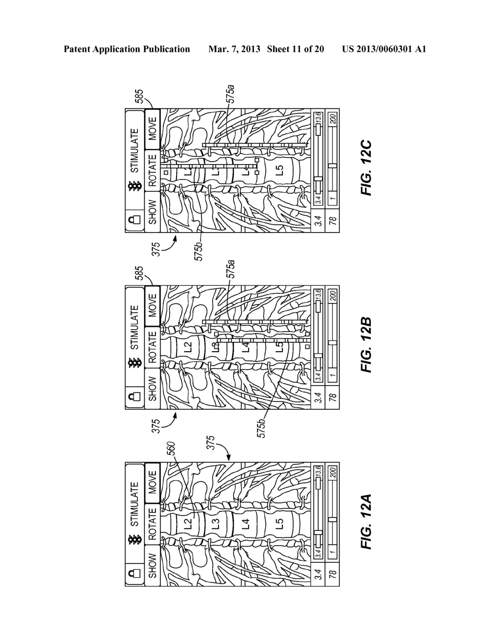 CONFIGURING ELECTRICAL STIMULATION TO TREAT A PATIENT - diagram, schematic, and image 12