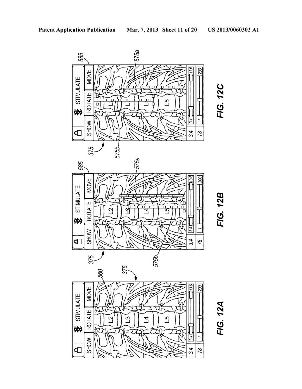 AUTOMATED SEARCH TO IDENTIFY A LOCATION FOR ELECTRICAL STIMULATION TO     TREAT A PATIENT - diagram, schematic, and image 12