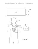 LEAD INCLUDING CONDUCTORS CONFIGURED FOR REDUCED MRI-INDUCED CURRENTS diagram and image