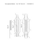 STENT DELIVERY SYSTEM HAVING STENT SECUREMENT APPARATUS diagram and image