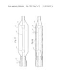 STENT DELIVERY SYSTEM HAVING STENT SECUREMENT APPARATUS diagram and image