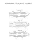 STENT DELIVERY SYSTEM HAVING STENT SECUREMENT APPARATUS diagram and image