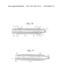 STENT DELIVERY SYSTEM HAVING STENT SECUREMENT APPARATUS diagram and image