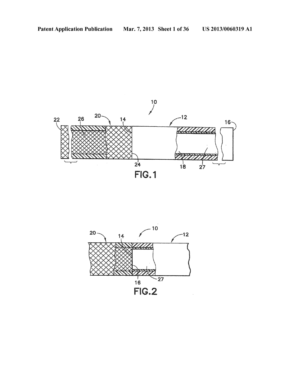 STENT/GRAFT ASSEMBLY - diagram, schematic, and image 02