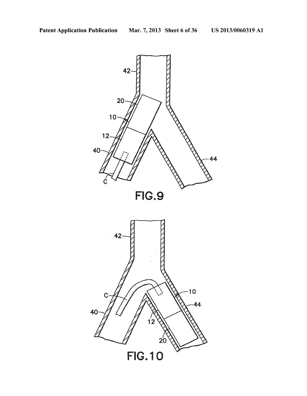 STENT/GRAFT ASSEMBLY - diagram, schematic, and image 07