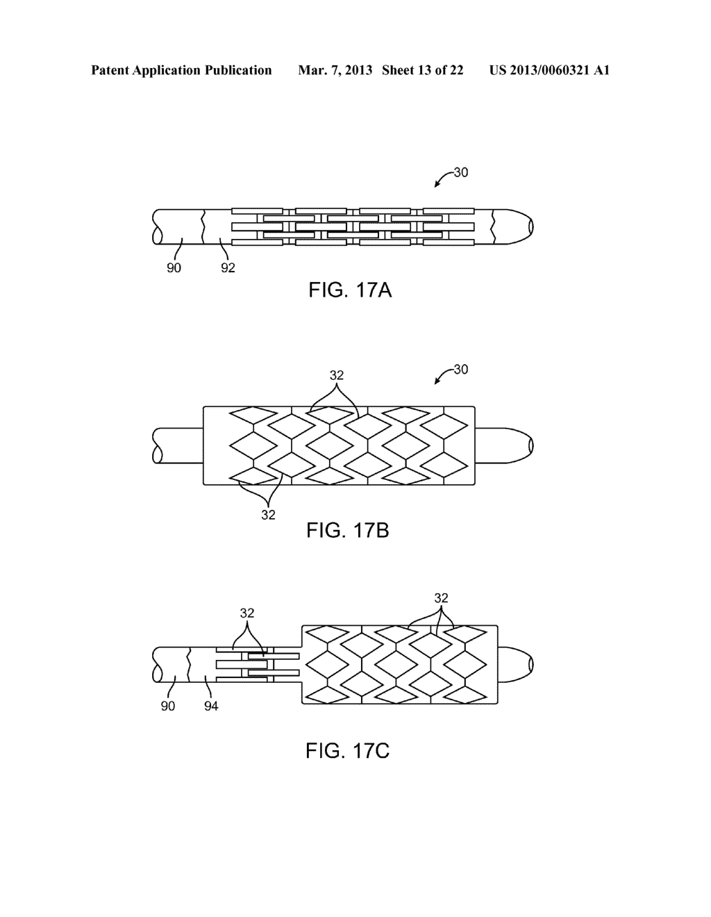 MULTIPLE INDEPENDENT NESTED STENT STRUCTURES AND METHODS FOR THEIR     PREPARATION AND DEPLOYMENT - diagram, schematic, and image 14