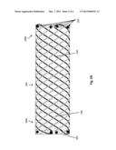 BRAIDED HELICAL WIRE STENT diagram and image