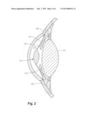 CONTRAST-ENHANCING ASPHERIC INTRAOCULAR LENS diagram and image