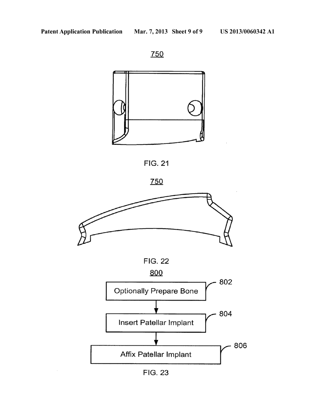 Method and System for Patella Tendon Realignment - diagram, schematic, and image 10