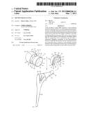 Hip Prosthesis System diagram and image