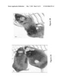 METHOD OF DIAGNOSING TRICHOTILLOMANIA AND SIMILAR DISORDERS IN HUMANS AND     RODENTS diagram and image