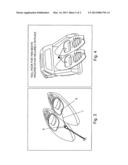 Small Craft Locking Device diagram and image