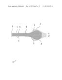 MEDICAL DEVICE AND METHODS OF DELIVERING THE MEDICAL DEVICE diagram and image