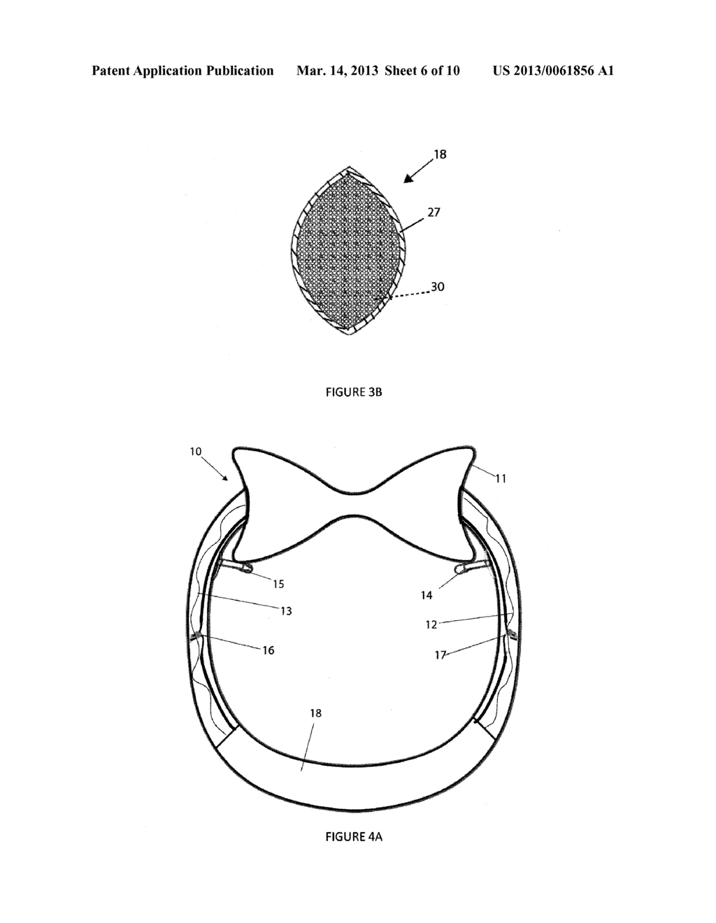 THERAPEUTIC DEVICE AND METHOD OF PROVIDING SPINAL SUPPORT - diagram, schematic, and image 07