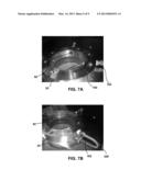 DIGESTER AND DIGESTION PROCESS diagram and image