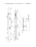 Multi-Zone Screened Fracturing System diagram and image