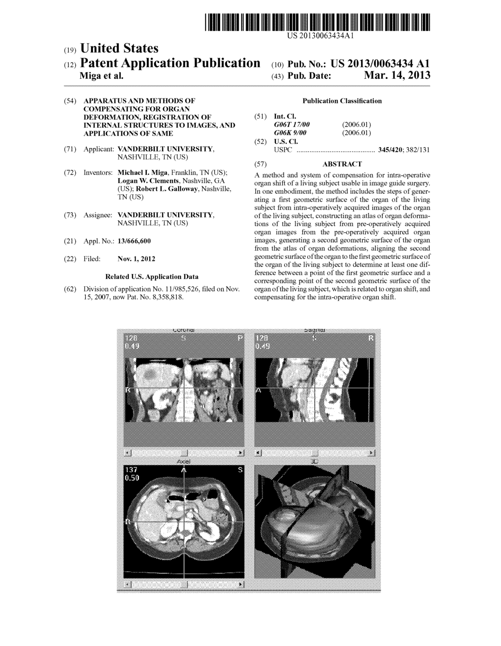 APPARATUS AND METHODS OF COMPENSATING FOR ORGAN DEFORMATION, REGISTRATION     OF INTERNAL STRUCTURES TO IMAGES, AND APPLICATIONS OF SAME - diagram, schematic, and image 01
