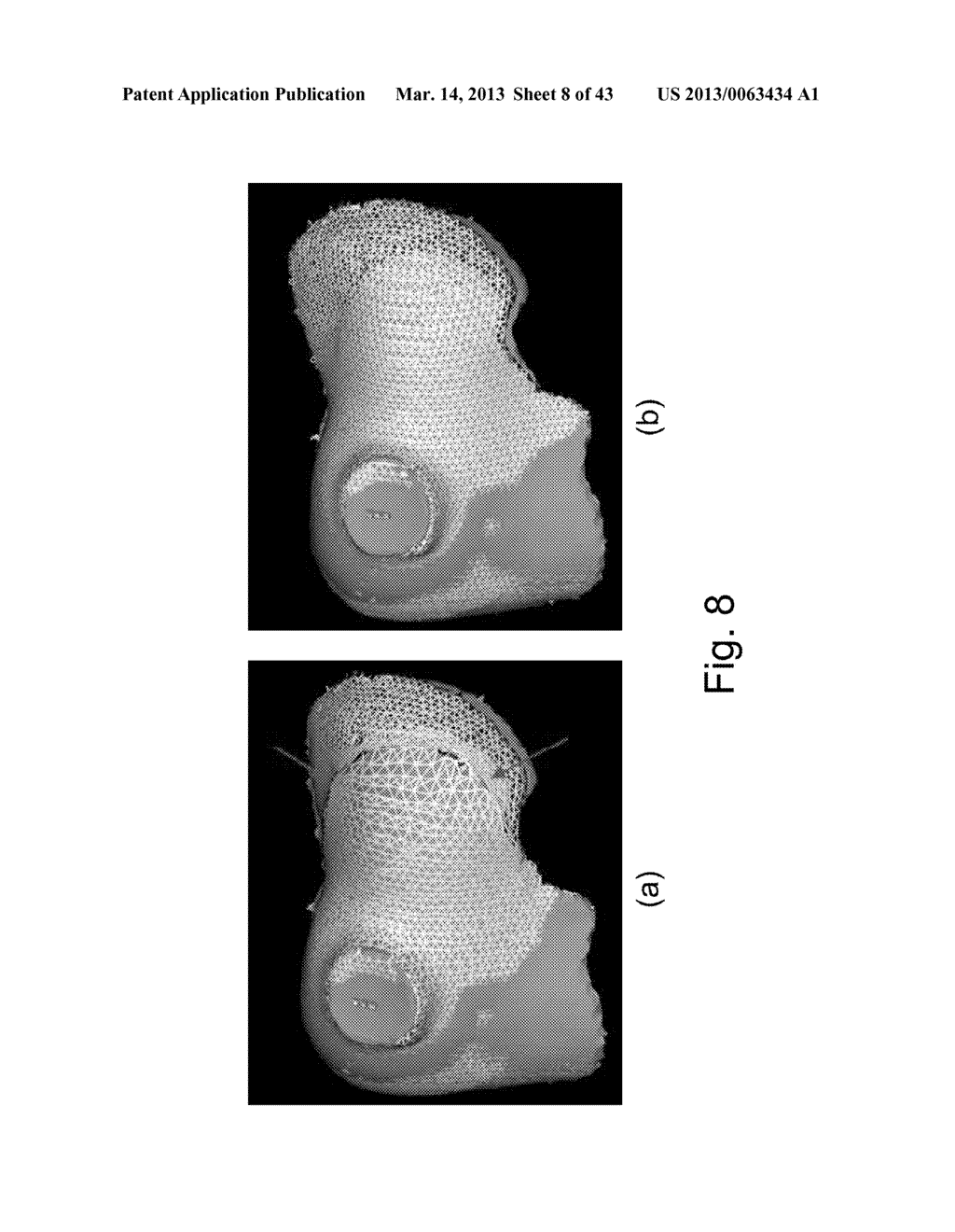 APPARATUS AND METHODS OF COMPENSATING FOR ORGAN DEFORMATION, REGISTRATION     OF INTERNAL STRUCTURES TO IMAGES, AND APPLICATIONS OF SAME - diagram, schematic, and image 09