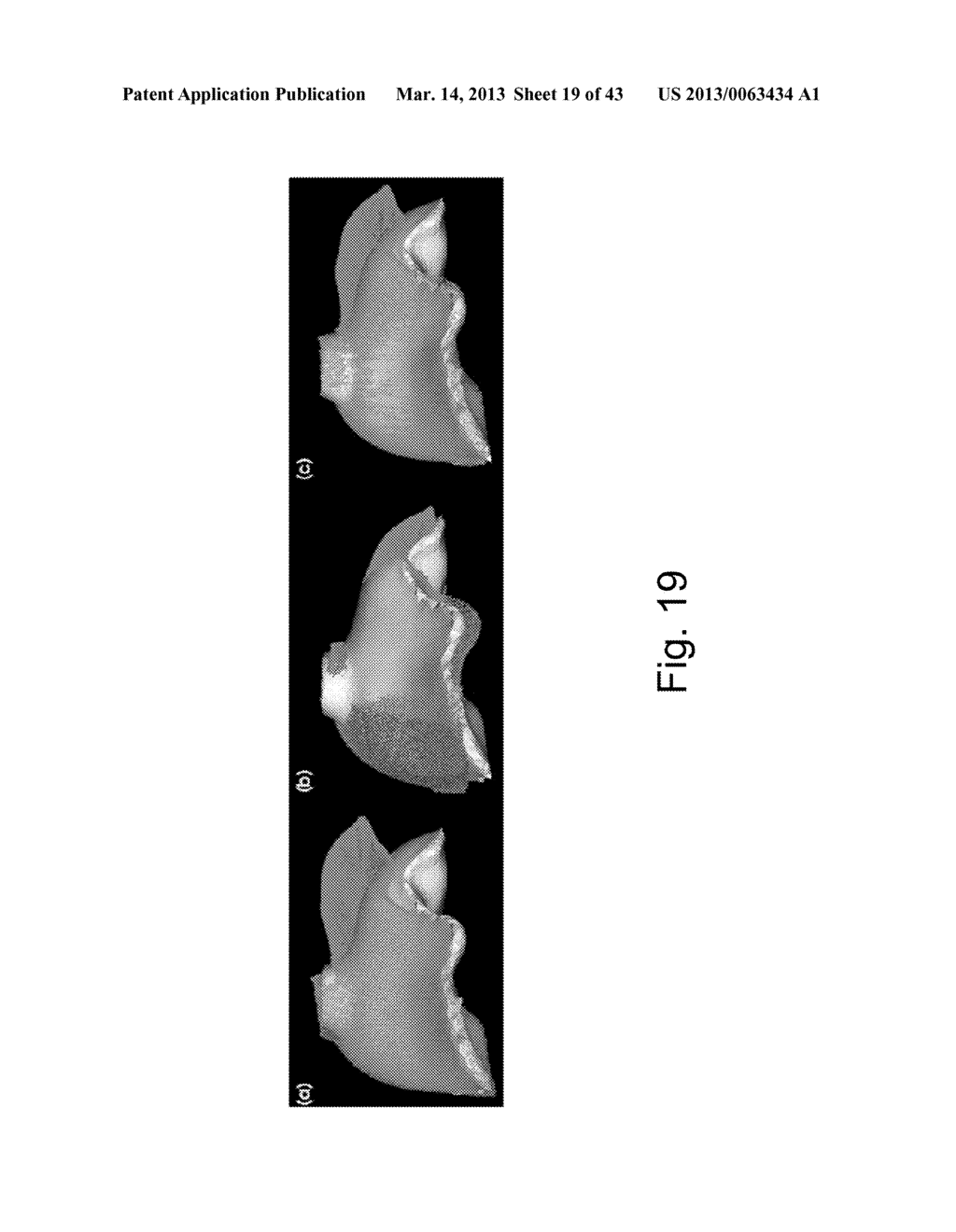 APPARATUS AND METHODS OF COMPENSATING FOR ORGAN DEFORMATION, REGISTRATION     OF INTERNAL STRUCTURES TO IMAGES, AND APPLICATIONS OF SAME - diagram, schematic, and image 20