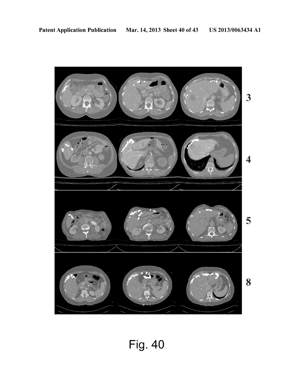 APPARATUS AND METHODS OF COMPENSATING FOR ORGAN DEFORMATION, REGISTRATION     OF INTERNAL STRUCTURES TO IMAGES, AND APPLICATIONS OF SAME - diagram, schematic, and image 41