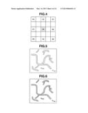 MEDICAL IMAGE PROCESSING APPARATUS AND METHOD OF OPERATING MEDICAL IMAGE     PROCESSING APPARATUS diagram and image