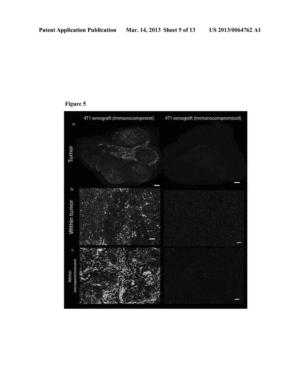 METHODS OF DETECTING AND TREATING CANCERS USING AUTOANTIBODIES - diagram, schematic, and image 06