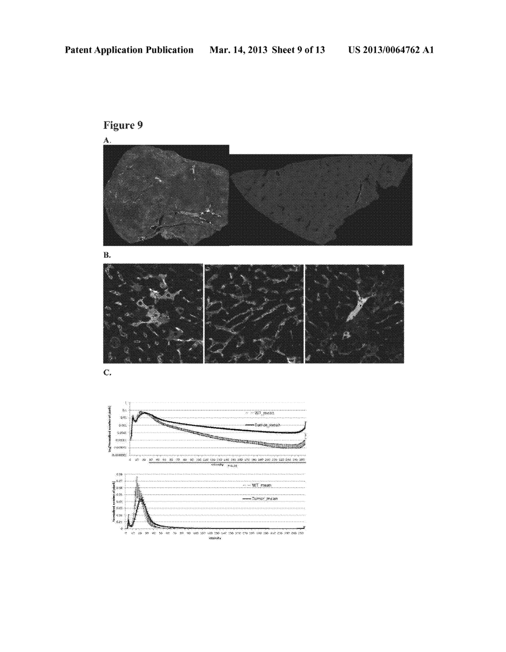 METHODS OF DETECTING AND TREATING CANCERS USING AUTOANTIBODIES - diagram, schematic, and image 10