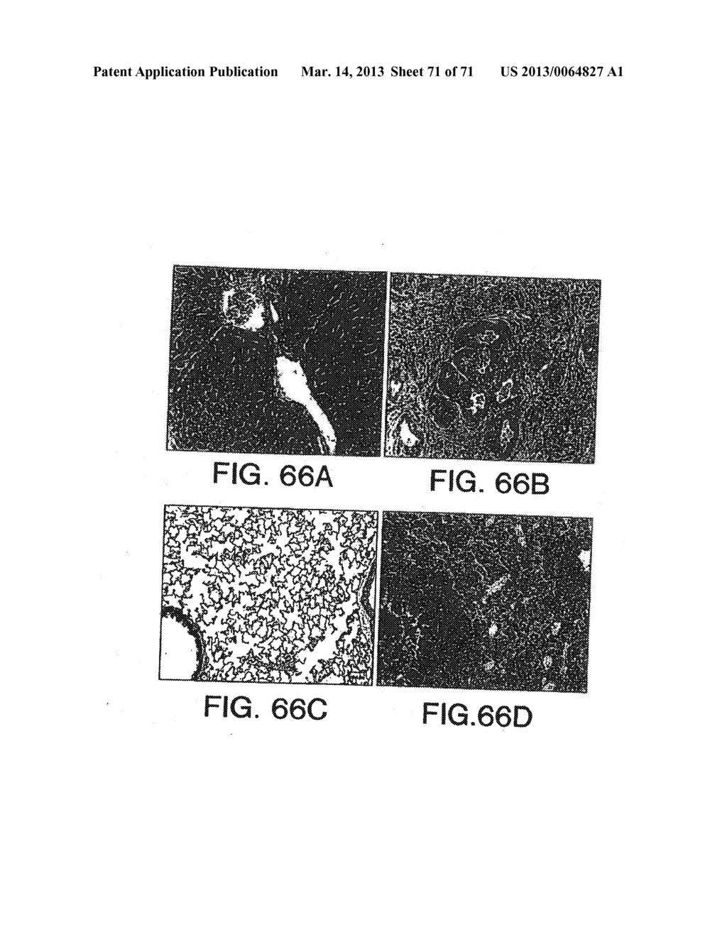 IL-17 HOMOLOGOUS POLYPEPTIDES AND THEREAPEUTIC USES THEREOF - diagram, schematic, and image 73