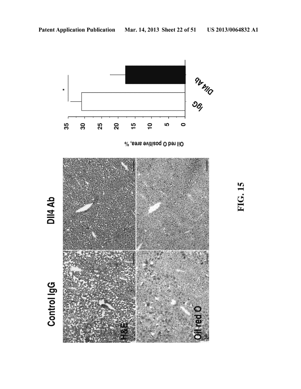 NOTCH INHIBITION IN THE TREATMENT AND PREVENTION OF A METABOLIC DISEASE OR     DISORDER AND CARDIOVASCULAR COMPLICATIONS THEREOF - diagram, schematic, and image 23