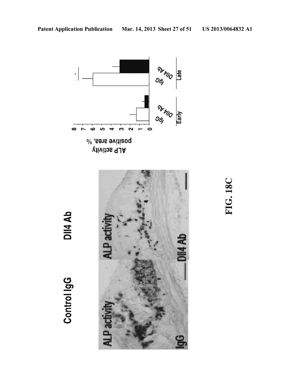 NOTCH INHIBITION IN THE TREATMENT AND PREVENTION OF A METABOLIC DISEASE OR     DISORDER AND CARDIOVASCULAR COMPLICATIONS THEREOF - diagram, schematic, and image 28