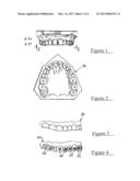 Procedure and device for enabling a dental element to be applied to a     dental arch diagram and image