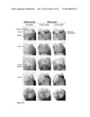 Kit and Method for Detecting Porous Dental Hydroxyapatite diagram and image