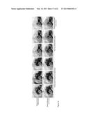 Kit and Method for Detecting Porous Dental Hydroxyapatite diagram and image