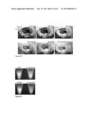 Kit and Method for Detecting Porous Dental Hydroxyapatite diagram and image