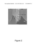 ULTRATHIN MAGNESIUM NANOBLADES diagram and image