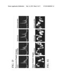 Method of Improving Diastolic Dysfunction diagram and image