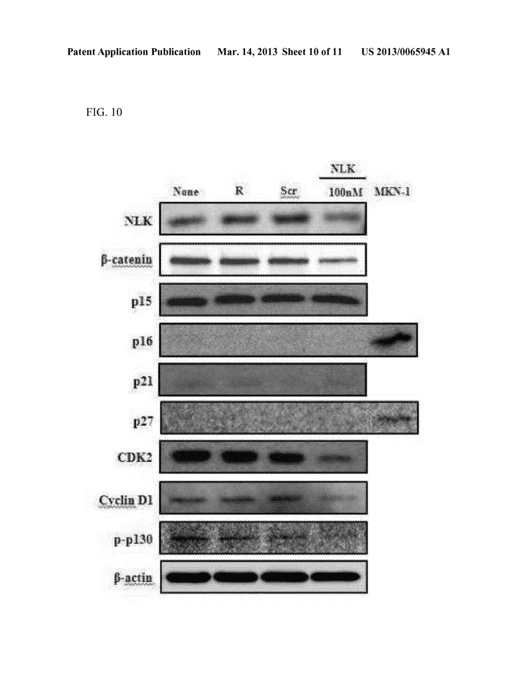 NLK AS A MARKER FOR DIAGNOSIS OF LIVER CANCER AND AS A THERAPEUTIC AGENT     THEREOF - diagram, schematic, and image 11