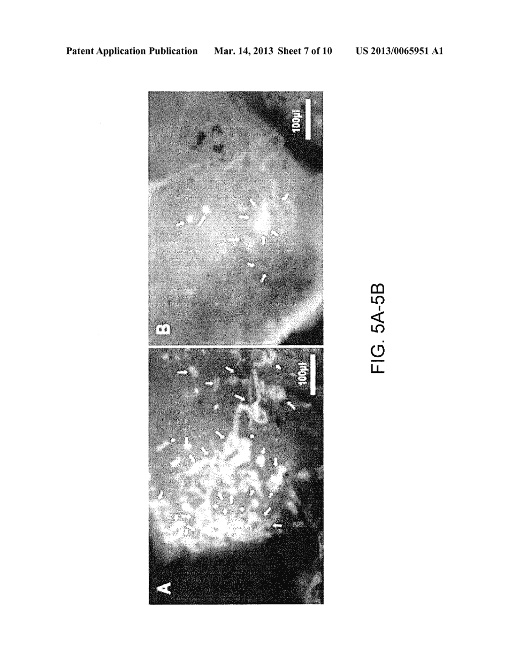 COMPOSITIONS AND METHODS RELATED TO MIRNA MODULATION OF NEOVASCULARIZATION     OR ANGIOGENESIS - diagram, schematic, and image 08